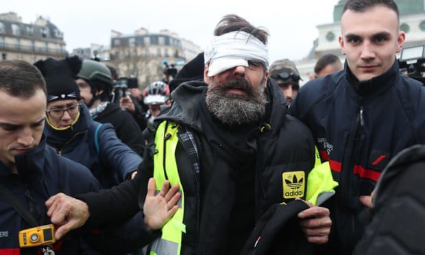 Francouzská policie používá proti žlutým vestám granáty s vysokým obsahem TNT